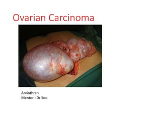 Ovarian Carcinoma
Arvinthran
Mentor : Dr Soo
 