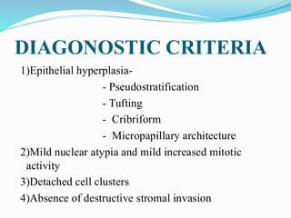DIAGONOSTIC CRITERIA
1)Epithelial hyperplasia-
- Pseudostratification
- Tufting
- Cribriform
- Micropapillary architecture
2)Mild nuclear atypia and mild increased mitotic
activity
3)Detached cell clusters
4)Absence of destructive stromal invasion
 
