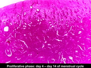 Proliferative phase: day 4 – day 14 of menstrual cycle
 