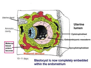 Maternal
blood
enters
lacunae
Uterine gland
Syncytiotrophoblast
Uterine
lumen
Extraembryonic mesoderm
Cytotrophoblast
Maternal decidua
Blastocyst is now completely embeddedBlastocyst is now completely embedded
within the endometriumwithin the endometrium
 