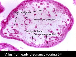 Villus from early pregnancy (during 3rd
Cytotrophoblast
Syncytiotrophoblast
Mesenchyme (embryonic CT)
Fetal capillaries
 