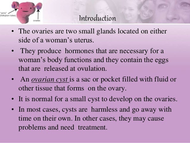 Ovarian cyst complaints picture