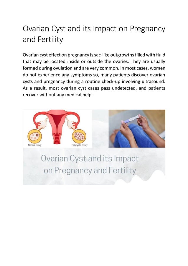 Ovarian Cyst and its Impact on Pregnancy and Fertility PDF