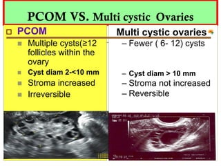 PCOM VS. Multi cystic Ovaries
 PCOM
 Multiple cysts(≥12
follicles within the
ovary
 Cyst diam 2-<10 mm
 Stroma increased
 Irreversible
Multi cystic ovaries
– Fewer ( 6- 12) cysts
– Cyst diam > 10 mm
– Stroma not increased
– Reversible
 