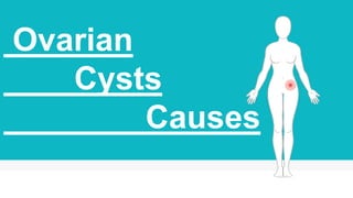 Ovarian
Cysts
Causes
 
