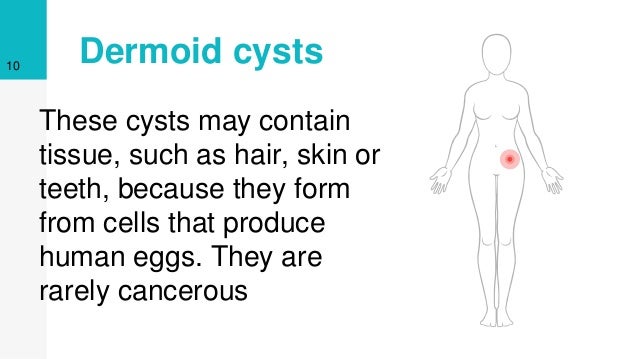 Serophene Menstrual Cycle