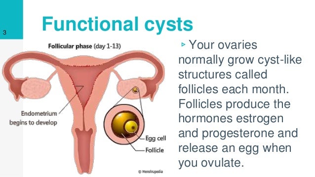 What are some causes of cysts?