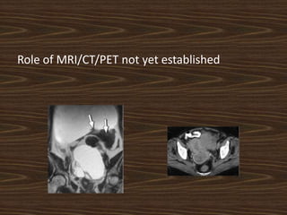 Role of MRI/CT/PET not yet established
 
