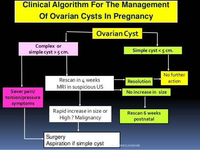 Ovarian Cyst Ovarian Cyst