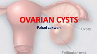OVARIAN CYSTS
Fahad zakwan
 