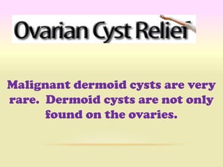 Malignant dermoid cysts are very
rare. Dermoid cysts are not only
      found on the ovaries.
 