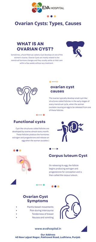WHAT IS AN
OVARIAN CYST?
ovarian cyst
causes
Corpus luteum Cyst
Functional cysts
Ovarian Cyst
Symptoms
The ovaries typically develop small cyst-like
structures called follicles in the early stages of
every menstrual cycle, when the woman
ovulates causing an egg to be released from one
of these follicles
On releasing its egg, the follicle
begins producing estrogen and
progesterone for conception and is
then called the corpus luteum.
Cyst-like structures called follicles are
developed by ovaries almost every month.
These follicles produce the hormones
estrogen and progesterone and release an
egg when the woman ovulates.l
Painful bowel movements
Pain during intercourse
Tenderness of breast
Nausea and vomiting
www.evahospital.in
Ovarian Cysts: Types, Causes
Sometimes, a fluid-filled sac called a Cyst develops on one of the
women's ovaries. Ovarian Cysts are mostly related to the
menstrual hormone changes and they usually settle on their own
within a few weeks without any treatment.
Our Address
40 New Lajpat Nagar, Pakhowal Road, Ludhiana, Punjab
 