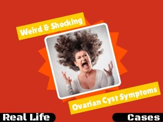 Weird & Shocking
Ovarian Cyst Symptoms
Real Life Cases
 