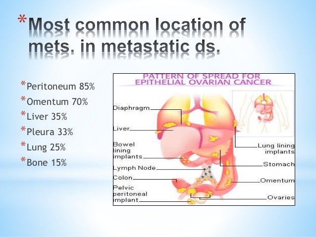 What are five signs of ovarian cancer?