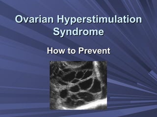 Ovarian Hyperstimulation Syndrome How to Prevent 