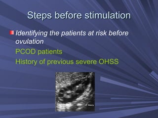 Steps before stimulation Identifying the patients at risk before ovulation PCOD patients History of previous severe OHSS 