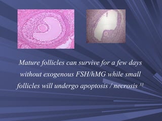 Mature follicles can survive for a few days without exogenous FSH/hMG while small follicles will undergo apoptosis / necrosis  33 