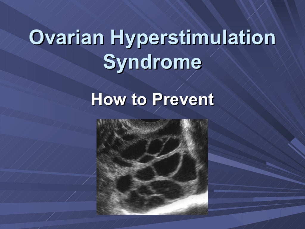 Ovarian hyperstimulation syndrome