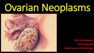 Ovarian Neoplasms
Dr.T.Arivazhagan
Post graduate
Department of Pathology
 