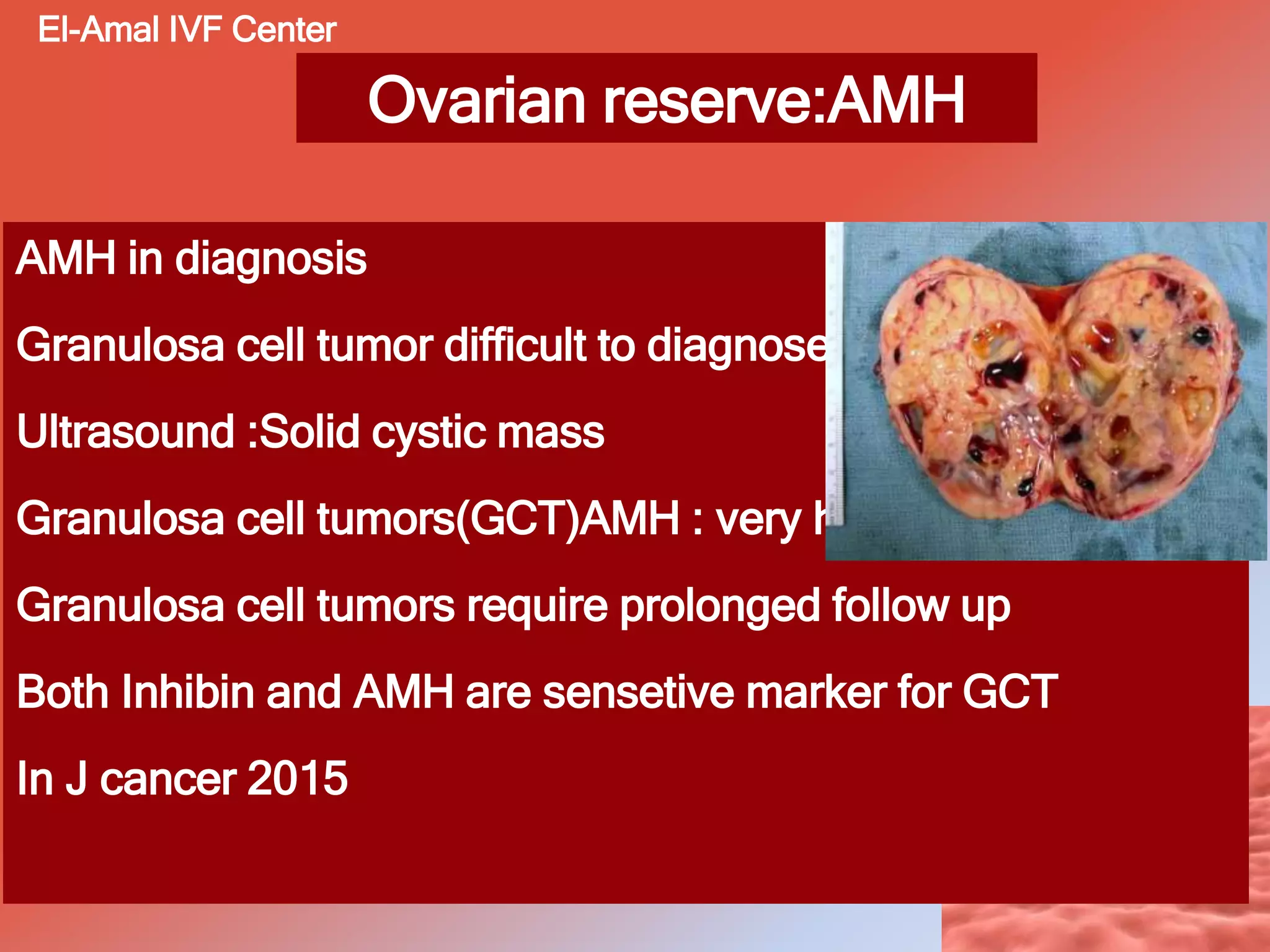 Ovarian reserve:AMH
AMH in diagnosis
Granulosa cell tumor difficult to diagnose
Ultrasound :Solid cystic mass
Granulosa cell tumors(GCT)AMH : very heigh levels
Granulosa cell tumors require prolonged follow up
Both Inhibin and AMH are sensetive marker for GCT
In J cancer 2015
El-Amal IVF Center
 