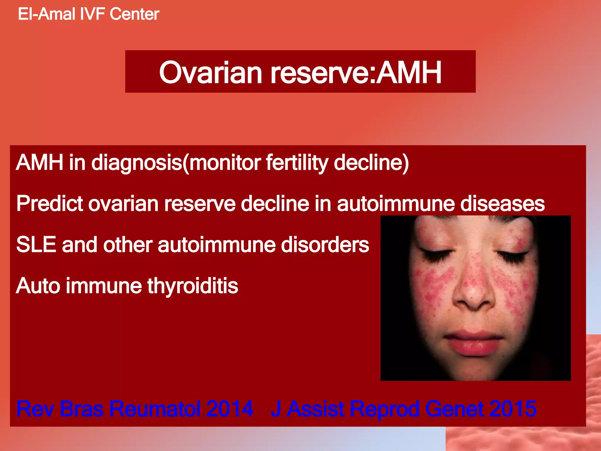 Ovarian reserve:AMH
AMH in diagnosis(monitor fertility decline)
Predict ovarian reserve decline in autoimmune diseases
SLE and other autoimmune disorders
Auto immune thyroiditis
Rev Bras Reumatol 2014 J Assist Reprod Genet 2015
El-Amal IVF Center
 