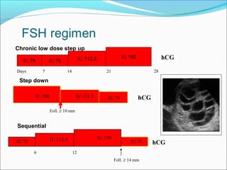 Days 7 14 21 28
hCG
150IU 112.5IU 75IU hCG
Foll. ≥ 10 mm
75IU112.5IU 150IU
6 12
75IU hCG
Foll. ≥ 14 mm
½
75IU 75IU 112.5IU 150IU
Chronic low dose step up
Step down
Sequential
 