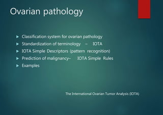 Ovarian pathology
 Classification system for ovarian pathology
 Standardization of terminology – IOTA
 IOTA Simple Descriptors (pattern recognition)
 Prediction of malignancy– IOTA Simple Rules
 Examples
The International Ovarian Tumor Analysis (IOTA)
 