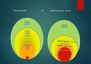 IOTA
Normal
ovaries
Premenopausal VS postmenopausal women
 