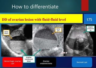 How to differentiate
 