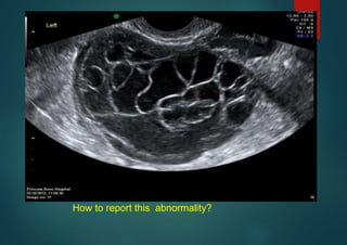 By the end of this presentation you will be able to report this!
How to report this abnormality?
 