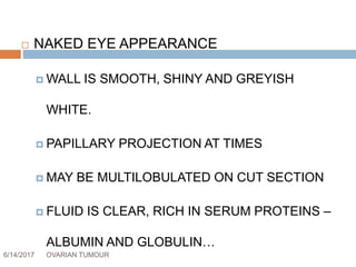 6/14/2017 OVARIAN TUMOUR 25
 NAKED EYE APPEARANCE
 WALL IS SMOOTH, SHINY AND GREYISH
WHITE.
 PAPILLARY PROJECTION AT TIMES
 MAY BE MULTILOBULATED ON CUT SECTION
 FLUID IS CLEAR, RICH IN SERUM PROTEINS –
ALBUMIN AND GLOBULIN…
 