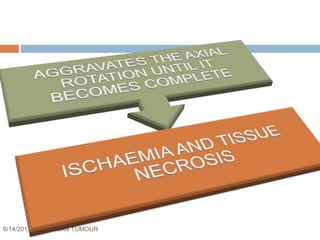 6/14/2017 OVARIAN TUMOUR 52
 
