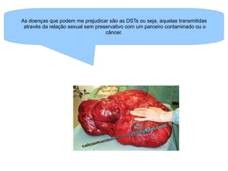 As doenças que podem me prejudicar são as DSTs ou seja, aquelas transmitidas através da relação sexual sem preservativo com um parceiro contaminado ou o câncer. 