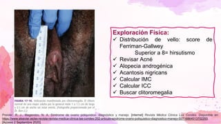 Exploración Física:
✓ Distribución de vello: score de
Ferriman-Gallwey
Superior a 8= hirsutismo
✓ Revisar Acné
✓ Alopecia androgénica
✓ Acantosis nigricans
✓ Calcular IMC
✓ Calcular ICC
✓ Buscar clitoromegalia
Preisler, R. J., Magendzo, N. A. Síndrome de ovario poliquístico. diagnóstico y manejo. [internet] Revista Médica Clínica Las Condes. Disponible en:
https://www.elsevier.es/es-revista-revista-medica-clinica-las-condes-202-articulo-sindrome-ovario-poliquistico-diagnostico-manejo-S0716864013702293.
[Acceso 2 Septiembre 2020].
 
