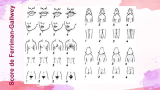 Score
de
Ferriman-Gallwey
 