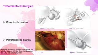Tratamiento Quirúrgico
➢ Cistectomía ovárica
➢ Perforación de ovarios
Whitridge Williams J. Williams ginecología. 2da
edición. México, D.F: Mc Graw- Hill Education;
2014. Pp 460- 480, 1026, 1139
 
