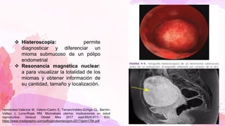 ❖ Histeroscopia: permite
diagnosticar y diferenciar un
mioma submucoso de un pólipo
endometrial
❖ Resonancia magnética nuclear:
a para visualizar la totalidad de los
miomas y obtener información de
su cantidad, tamaño y localización.
Hernández-Valencia M, Valerio-Castro E, TerceroValdez-Zúñiga CL, Barrón-
Vallejo J, Luna-Rojas RM. Miomatosis uterina: implicaciones en salud
reproductiva. Ginecol Obstet Mex 2017 sept;85(9):611- 633.
https://www.medigraphic.com/pdfs/ginobsmex/gom-2017/gom179h.pdf
 