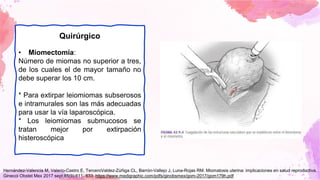 Quirúrgico
• Miomectomía:
Número de miomas no superior a tres,
de los cuales el de mayor tamaño no
debe superar los 10 cm.
* Para extirpar leiomiomas subserosos
e intramurales son las más adecuadas
para usar la vía laparoscópica.
* Los leiomiomas submucosos se
tratan mejor por extirpación
histeroscópica
Hernández-Valencia M, Valerio-Castro E, TerceroValdez-Zúñiga CL, Barrón-Vallejo J, Luna-Rojas RM. Miomatosis uterina: implicaciones en salud reproductiva.
Ginecol Obstet Mex 2017 sept;85(9):611- 633. https://www.medigraphic.com/pdfs/ginobsmex/gom-2017/gom179h.pdf
 