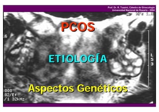 Prof. Dr. R. Tozzini, Cátedra de Ginecología
                   Universidad Nacional de Rosario - 2004




     PCOS

   ETIOLOGÍA

Aspectos Genéticos
 