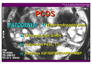 Prof. Dr. R. Tozzini, Cátedra de Ginecología
                                  Universidad Nacional de Rosario - 2004




            PCOS
PATOGENIA: 1) Hiperandrogenismo
           1) Hiperandrogenismo

    a) Disrregulación GnRH

    b) Activación P450C 17α
                      C


    c) Sistemas IGF/IGFBP/PAPPA-MBP
 