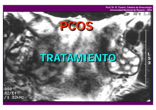 Prof. Dr. R. Tozzini, Cátedra de Ginecología
             Universidad Nacional de Rosario - 2004




  PCOS

TRATAMIENTO
 
