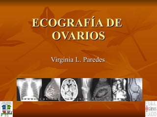 ECOGRAFÍA DE  OVARIOS Virginia L. Paredes 