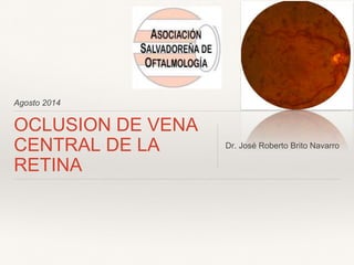 Agosto 2014 
OCLUSION DE VENA 
CENTRAL DE LA 
RETINA 
Dr. José Roberto Brito Navarro 
 