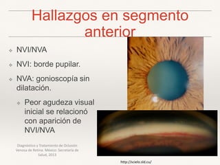 Hallazgos en segmento
anterior
❖ NVI/NVA
❖ NVI: borde pupilar.
❖ NVA: gonioscopía sin
dilatación.
❖ Peor agudeza visual
inicial se relacionó
con aparición de
NVI/NVA
Diagnóstico y Tratamiento de Oclusión
Venosa de Retina. México: Secretaría de
Salud, 2013
http://scielo.sld.cu/
 