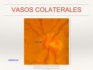 VASOS COLATERALES
Diagnóstico y Tratamiento de Oclusión
Venosa de Retina. México: Secretaría de
medigraphic.com
 