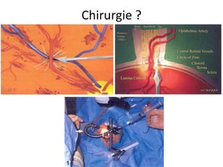 Chirurgie ?