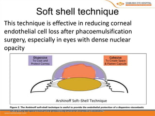 Cornial Shell ophthalmic viscosurgical devices | PPTX