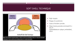 SOFT SHELL TECHNIQUE
 High myopia
 Floppy iris syndrome
 Cases of broken zonules
 https://www.youtube.com/watch?v=
dX_YT-
uqzAw&feature=player_embedded_
uturn
 