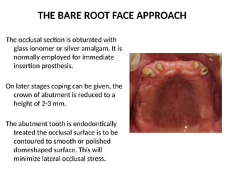 THE BARE ROOT FACE APPROACH
The occlusal section is obturated with
glass ionomer or silver amalgam. It is
normally employed for immediate
insertion prosthesis.
On later stages coping can be given, the
crown of abutment is reduced to a
height of 2-3 mm.
The abutment tooth is endodontically
treated the occlusal surface is to be
contoured to smooth or polished
domeshaped surface. This will
minimize lateral occlusal stress.
 