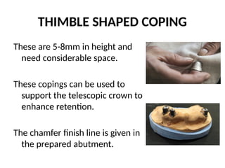 THIMBLE SHAPED COPING
These are 5-8mm in height and
need considerable space.
These copings can be used to
support the telescopic crown to
enhance retention.
The chamfer finish line is given in
the prepared abutment.
 